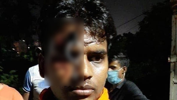 हेलमेट न पहनने पर पुलिस ने युवक का किया ऐसा हाल, देखकर हो जाएंगे हैरान
