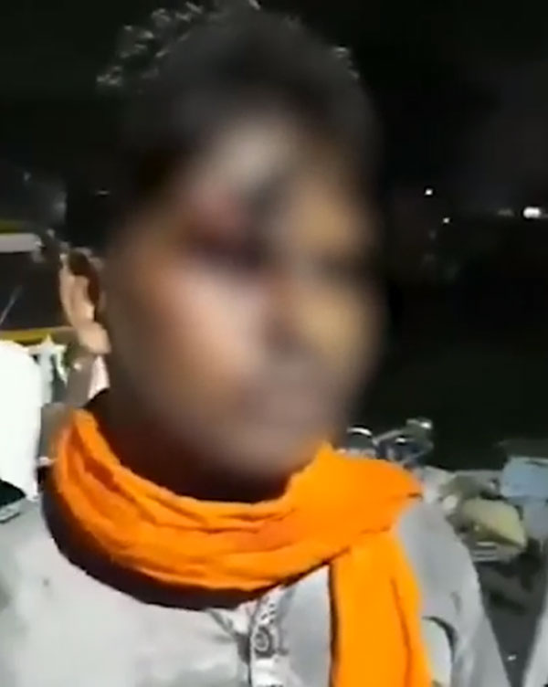 हेलमेट न पहनने पर पुलिस ने युवक का किया ऐसा हाल, देखकर हो जाएंगे हैरान